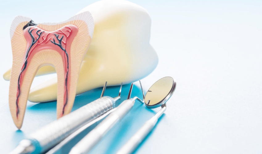 Endodontics in Prosper