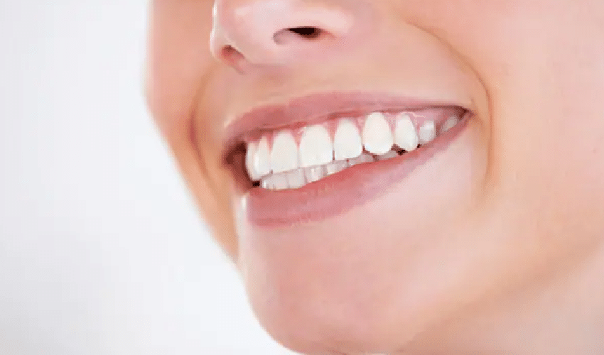 Teeth Whitening Treatment in Prosper