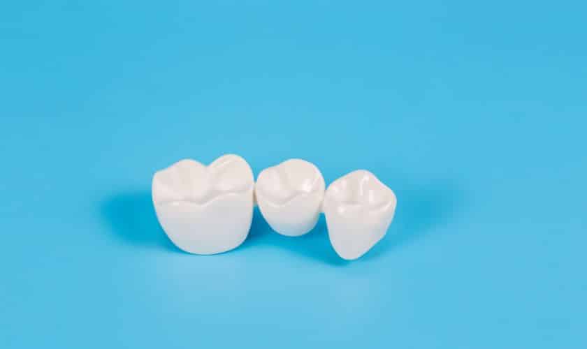 Dental crown in prosper