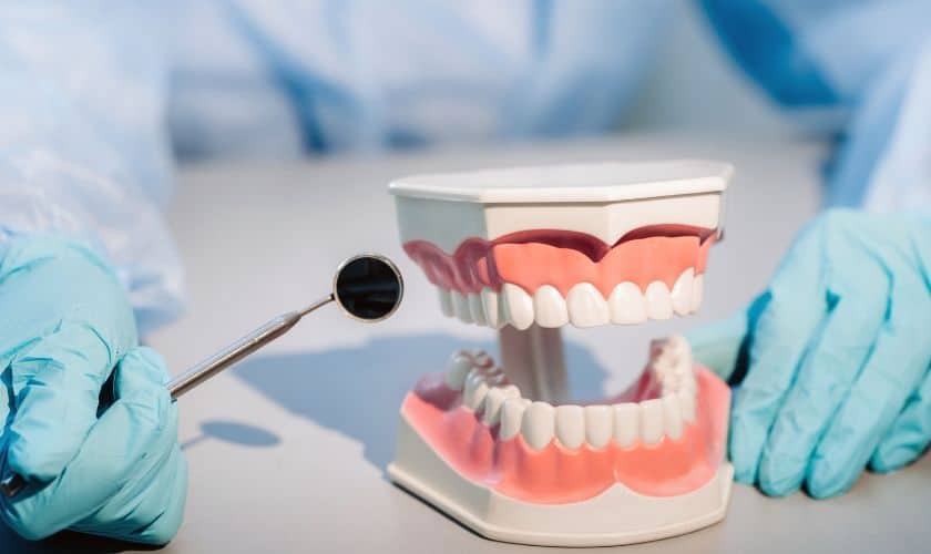dental restorations