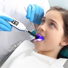 Dentist using UV light to cure dental filling on young patient's tooth during treatment.