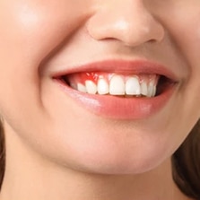 Close-up of a woman's bright, healthy smile displaying white teeth and natural lip color.
