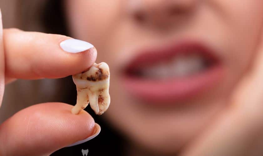cracked tooth treatment