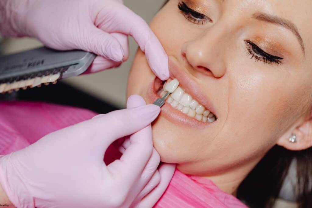 Can Veneers Be Adjusted After Placement