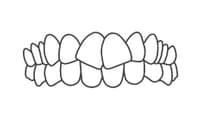Front view of aligned upper and lower teeth showing proper dental occlusion and smile aesthetics.