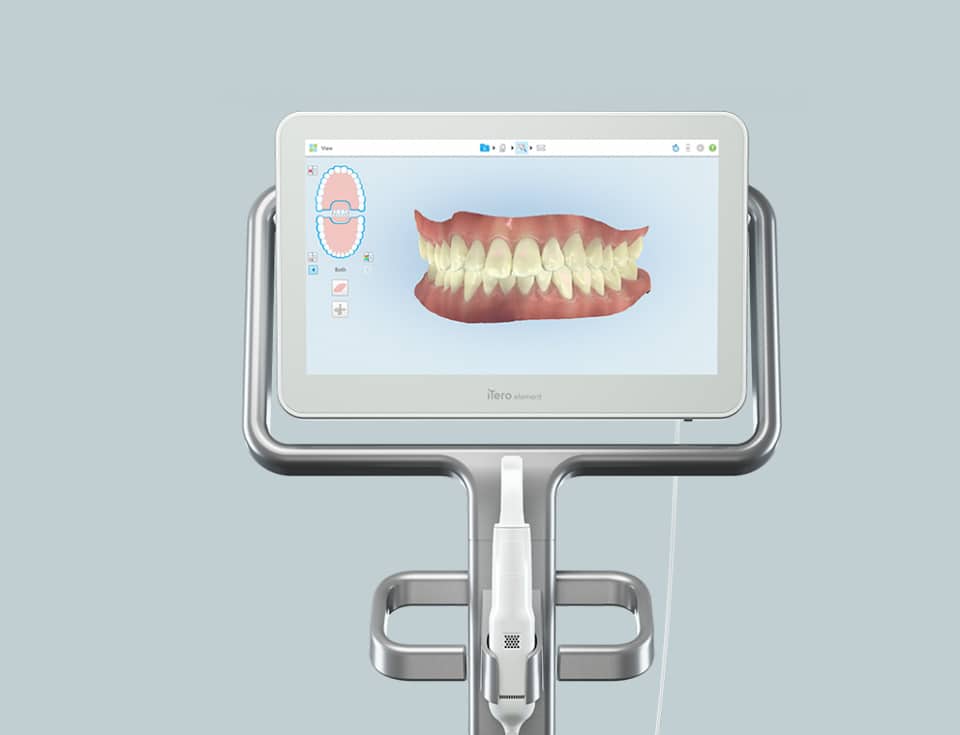Digital dental display showing 3D scan of teeth and gum model on monitor stand