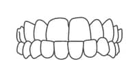 Illustration of properly aligned upper and lower teeth showing ideal dental occlusion and bite alignment.
