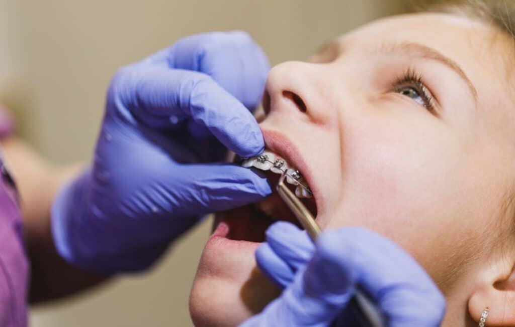Braces Pain