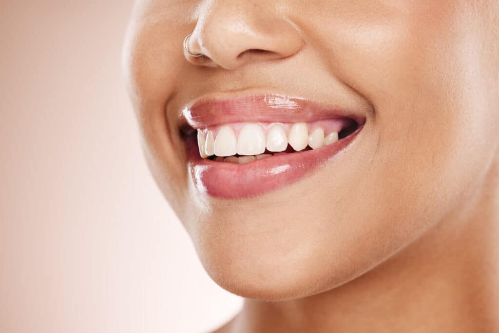 The Power of a Smile: Top Benefits of Cosmetic Dentistry