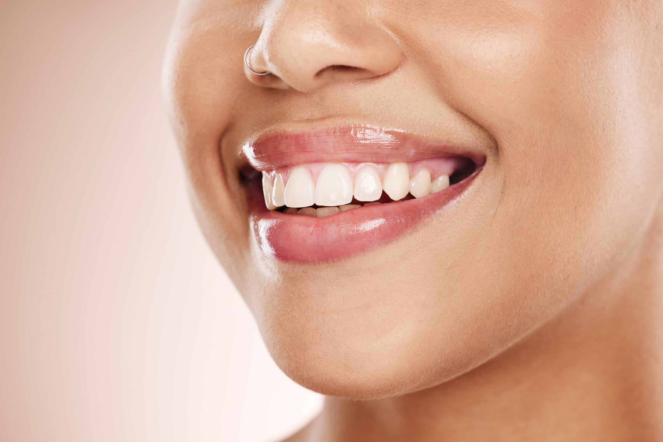 The Power of a Smile: Top Benefits of Cosmetic Dentistry