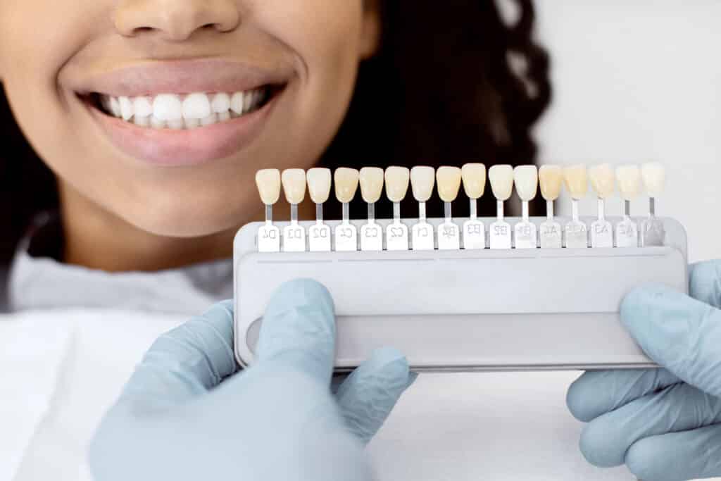 Can You Drink Coffee with Veneers? What You Should Know