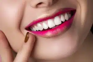 Teeth whitening treatment